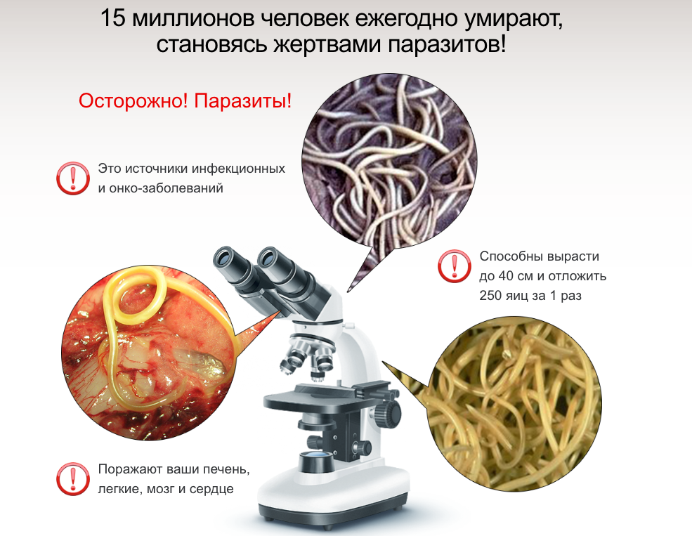 Чем вывести глистов из организма человека в домашних условиях Чем вывести глистов из организма человека в домашних условиях