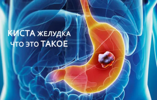 образование в жуледке