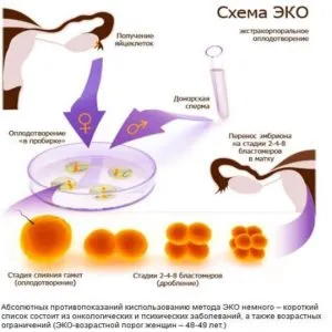 схема эко