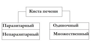 Виды кист печени