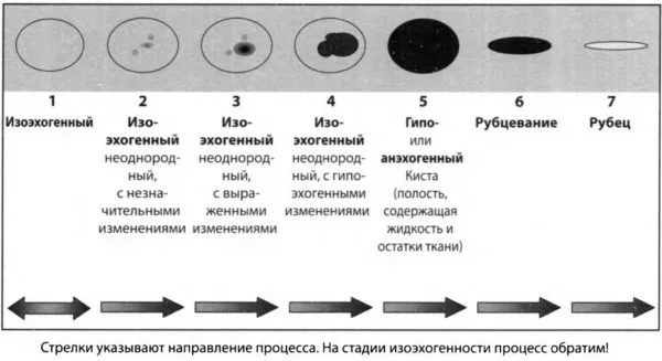 стадии развития узлов