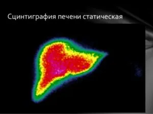 станциграфия 