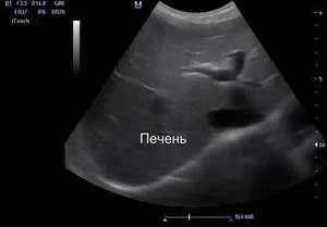 эхопризнаки