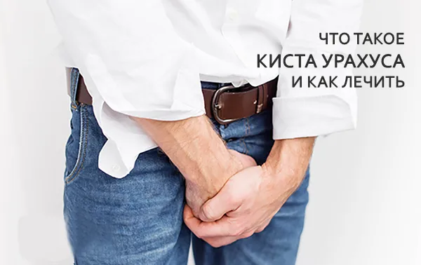 что такое урахус