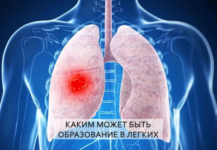 каким может быть новообразование