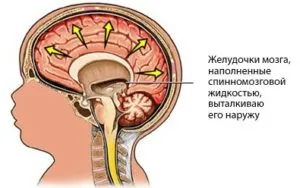 ликвор в мозгу у ребенка