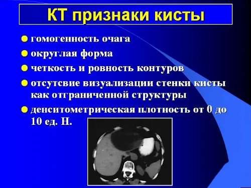 кт признаки