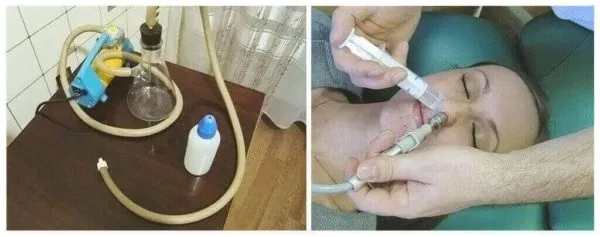 метод кукушки
