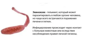 эхинококк лечение