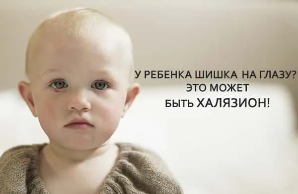на глазу выскочило у ребенка