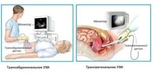 виды узи