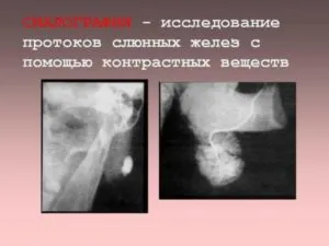 силография слюнных