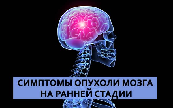 Симптомы онкологии головного мозга. Симптоматика опухолей головного мозга. Симптомы опухоли головного. Опухоль головного мозга симптомы на ранних стадиях у женщин.