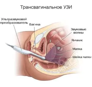 твузи