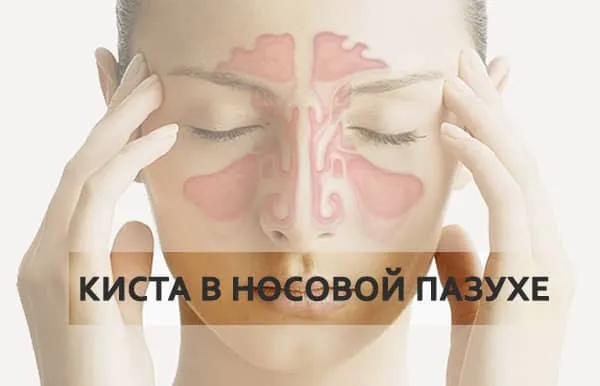 пазухи носа