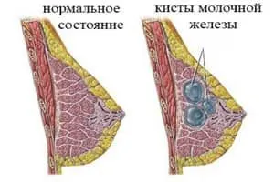 схема груди