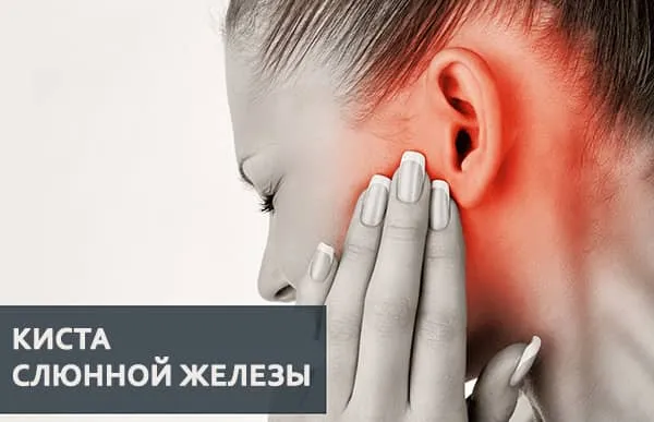 опухоль шеи