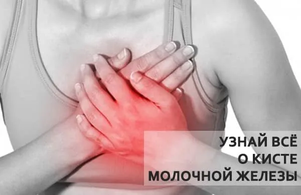 о кисте в груди