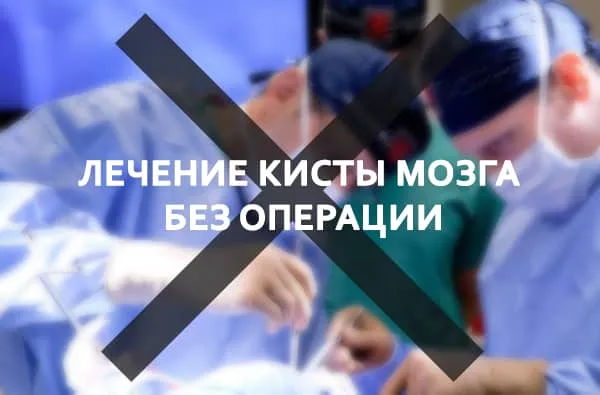 безоперационное лечение мозга