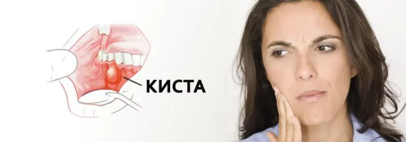 опухло во рту