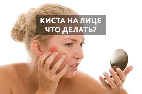 большой прыщ на лице