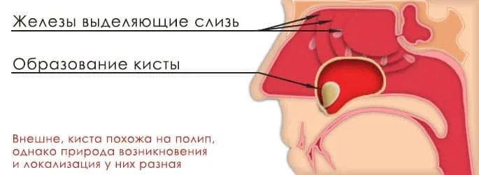 верхнечелюстные пазухи