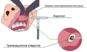 метод Калдвелл-Люка