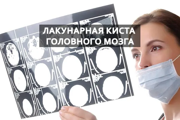 мрт снимок головного мозга