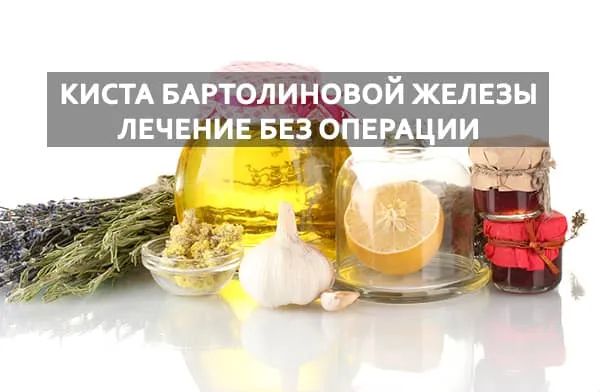 киста бартолита народными средствами