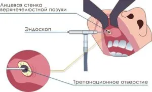 эндоскопия 