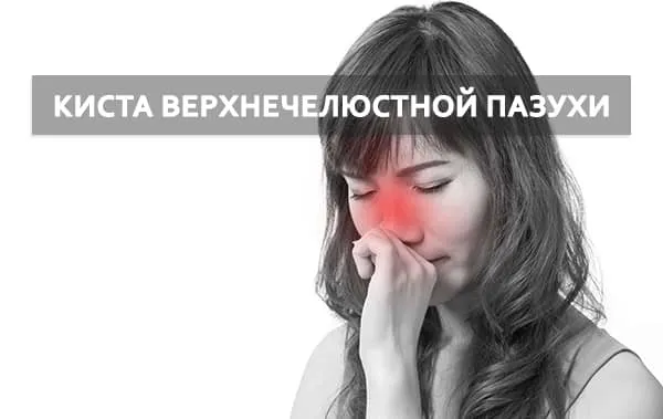 киста в носу