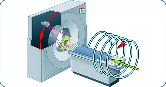 Спиральная компьютерная томография