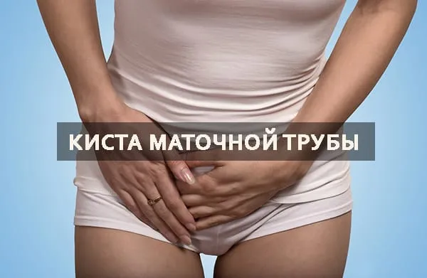 киста матки