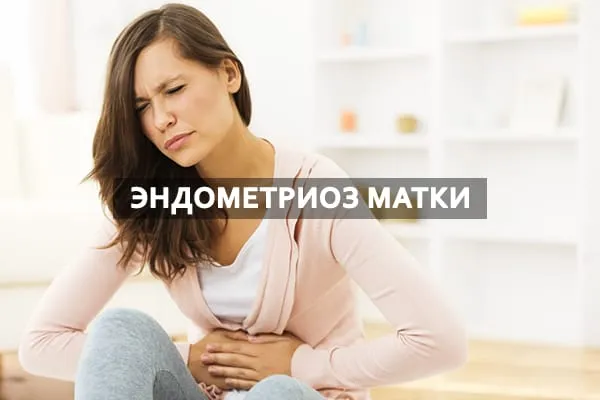 эндометриоз
