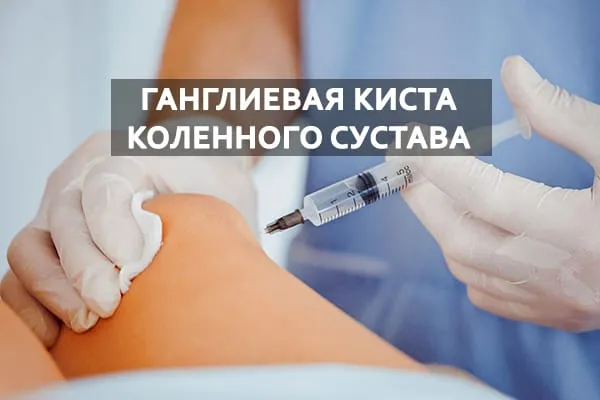 ганглиевая киста