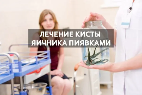 лечение пиявками