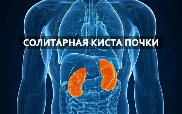 солитарное образование