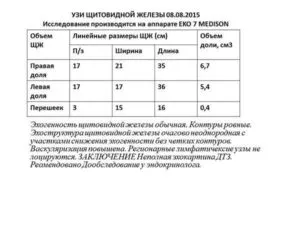 пример результата УЗИ