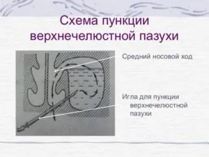 схема пункции