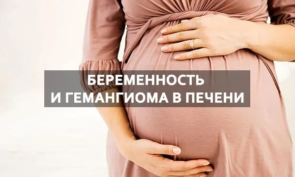 гемангиома у беременных